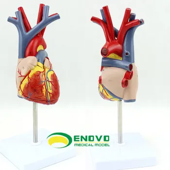 Koronárna angiografia anglický ischemickej choroby srdca intervenčná kardiológia