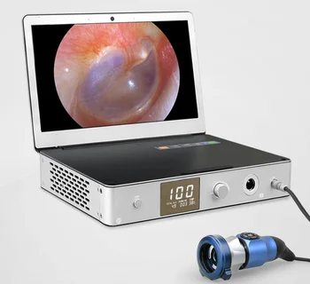 Prenosné lekárske hd endoskopu systém, skontrolujte, all-in-one otolaryngology endoskopická surgeryWith a 11.6 -palcový monitor